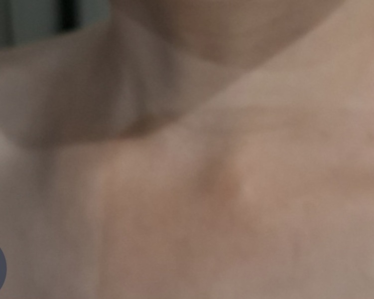 Would you worry if your 7yo had these swellings?