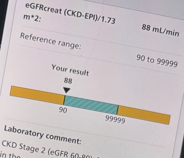 CKD result!