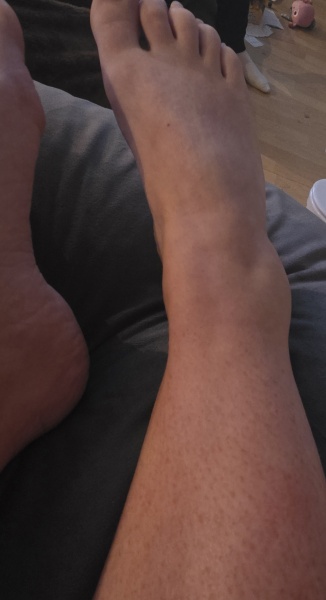 Hurt my ankle...should I get it checked?