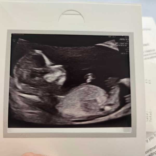Boy or girl? 💙🩷
