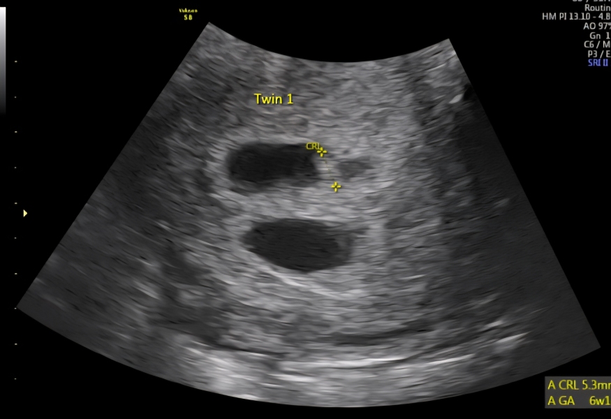 Anyone Doing FET/IVF Cycles in November 2025?