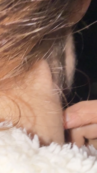 Lump on neck?