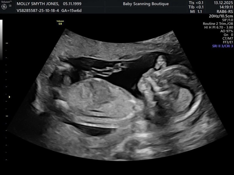 Gender guesses?