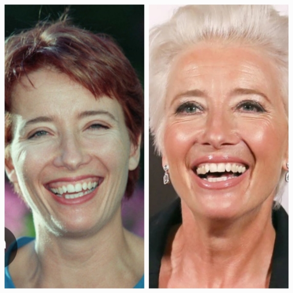 I know everyone on MN claims not to have lines and wrinkles but ...but