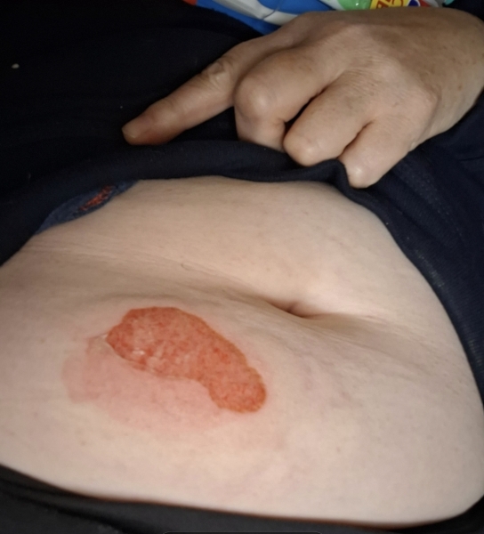 Do I need medical attention? Any Dr's about?