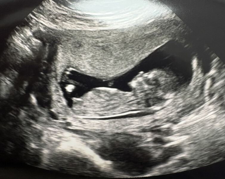 Nub theory - early glimpse