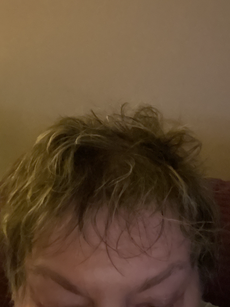 I know everyone on MN claims not to have lines and wrinkles but ...but