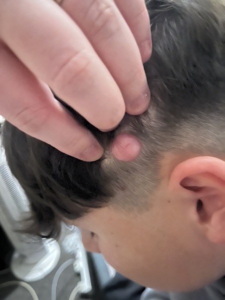 17yr son suspected cancer?!