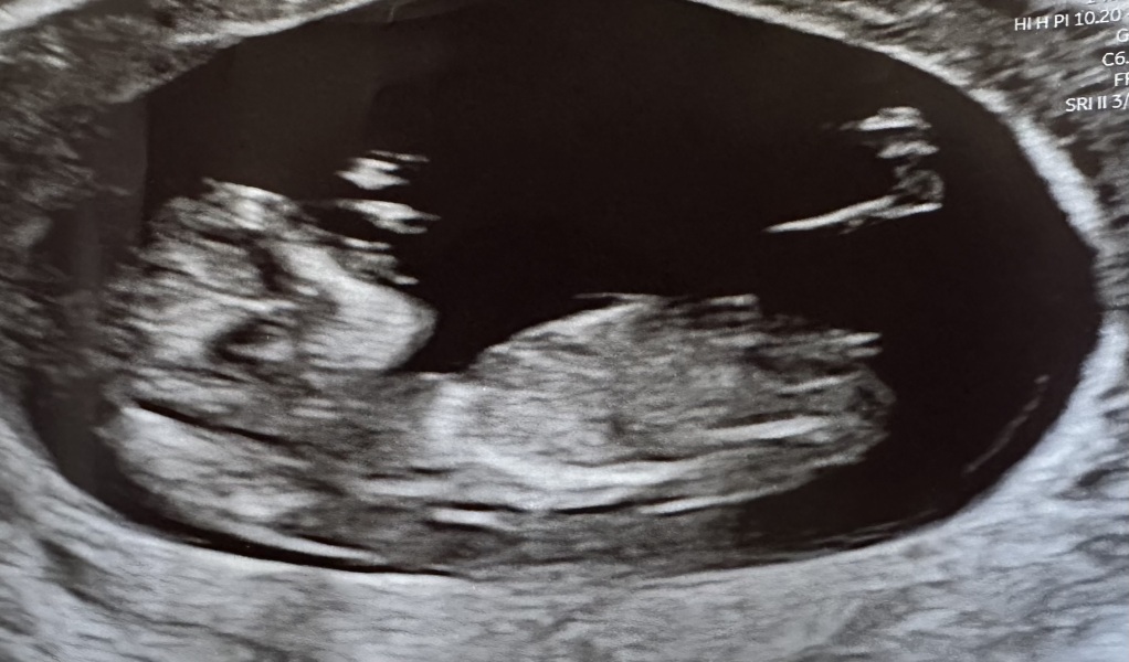 Due July 2026 🤍