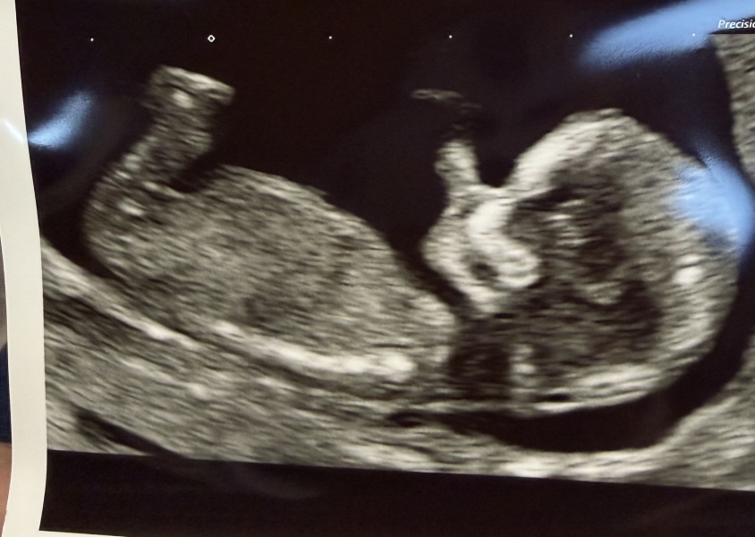 Boy or girl?