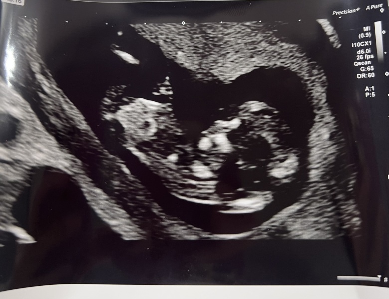 Boy or girl