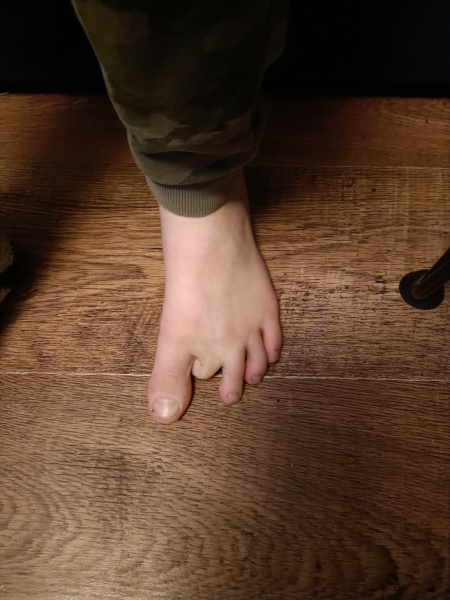 To ask if you counted fingers and toes when your baby was born?