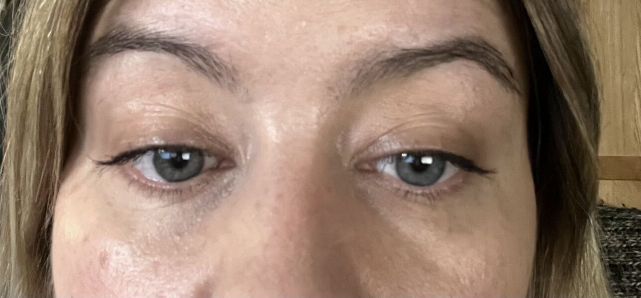 How to cover these dark circles