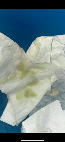To think it could be pneumonia - day 17
