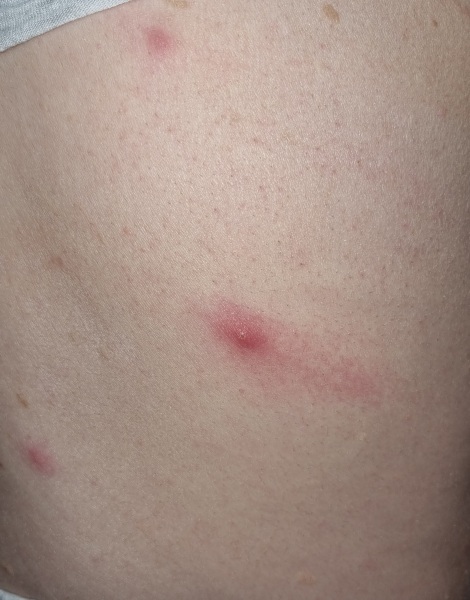 What are these spots?