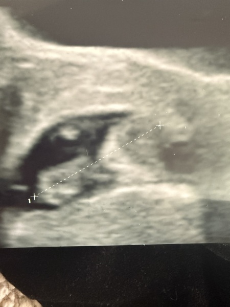 Boy or girl 💙💖