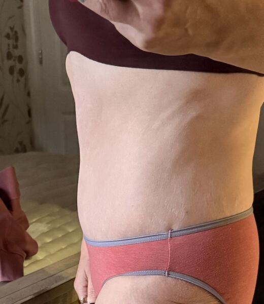 Why am I shaped like a rectangle and how should I dress? Pics included