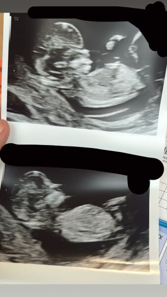Boy or girl Predictions?