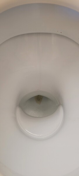 Does anyone know what this is in my toilet? (Image attached)