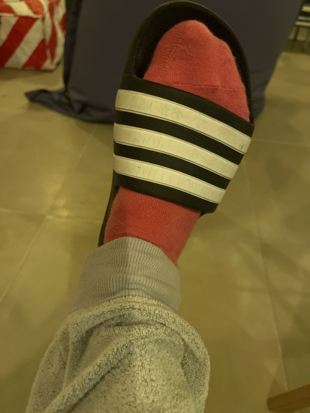 Oh god just looked down - whats on your feet, does it show your age??