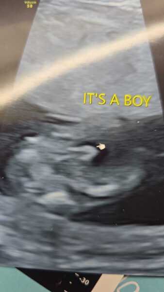 5 weeks and no symptoms - not even sore boobs