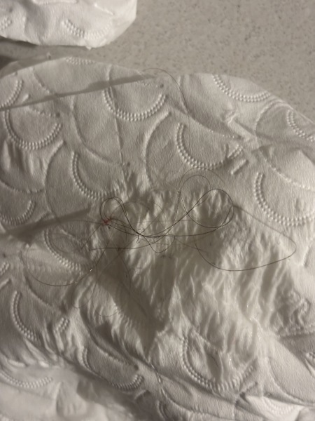 Are these still nitts and is it a lot?