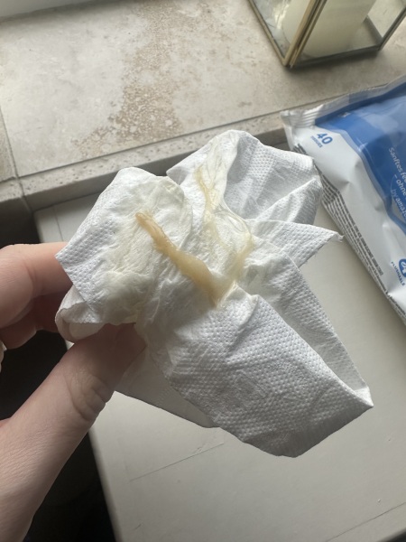 Could this be my mucous plug at 12 weeks?