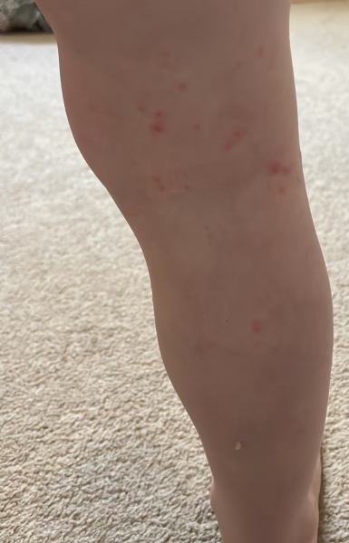 What are these spots? DS (2)
