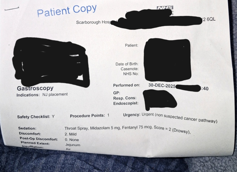 Anyone had a gastroscope? I have one booked on Friday and petrified.
