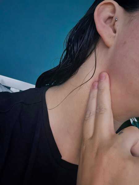 Health anxiety help! Sorry!
