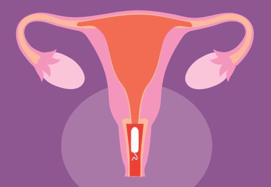 Periods after medical abortion