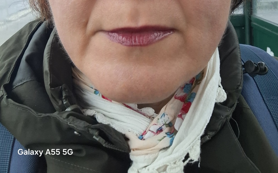 Lip fillers- are the agony?