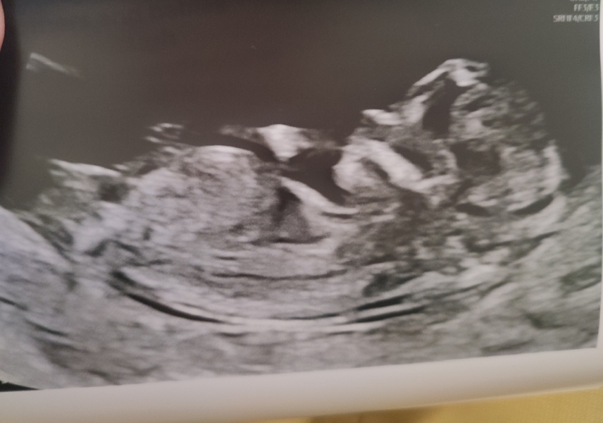 please help me guess the gender ☺️ (scan pic included)
