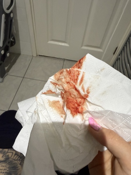 5 weeks pregnant, does this look like a miscarriage?