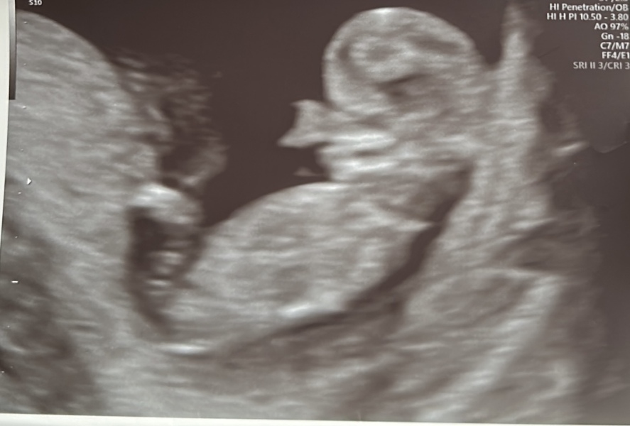 Boy or girl??