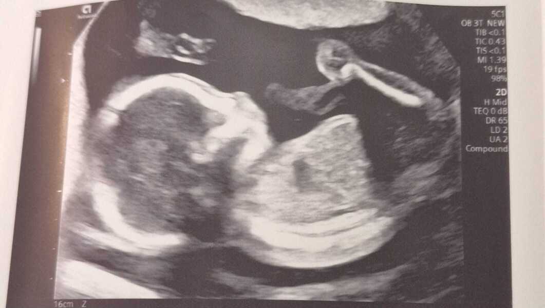 Anyone due May 2026