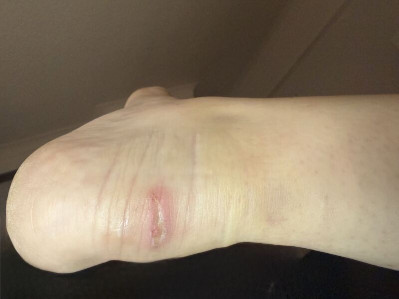 Is this infected?