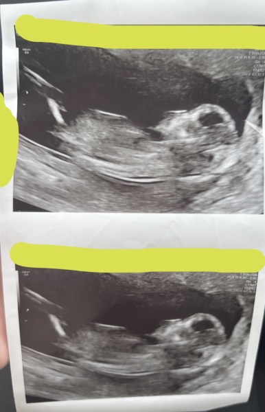 Hi, any guesses on the gender please