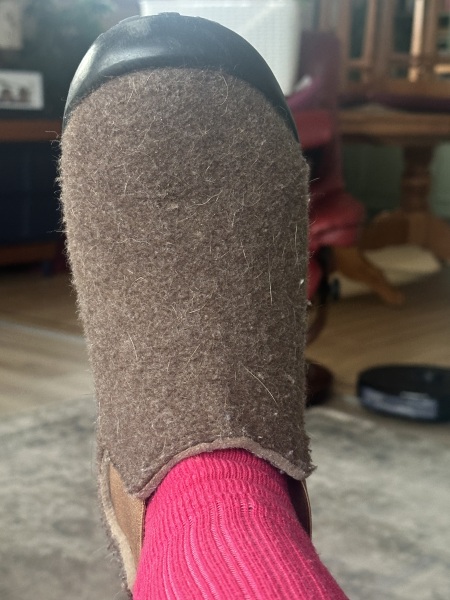 Oh god just looked down - whats on your feet, does it show your age??