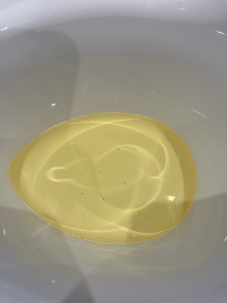 (Toddler wee picture) UTI? Threadworm?