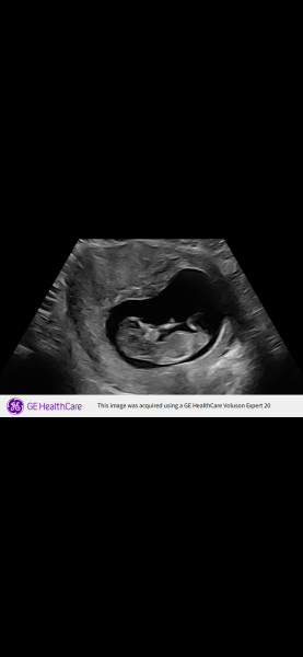 Is it a boy or a girl?