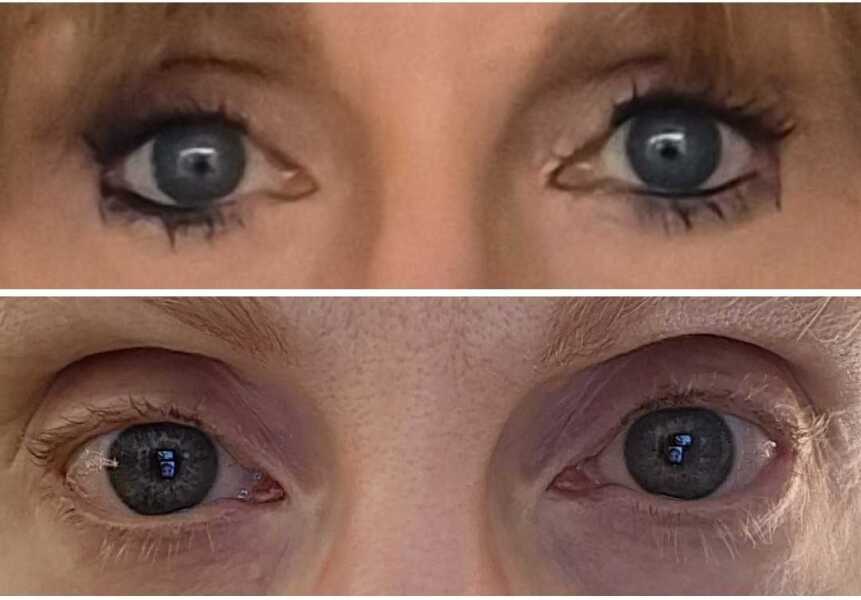 Eye makeup advice please -dry eyes and have to give up my beloved eyeliner