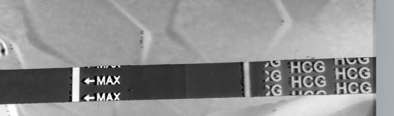 Thoughts? Experiences? Faints lines