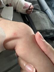 10 week old baby- unidentified cause of rashes