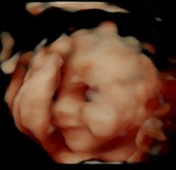 Pregnant with first baby