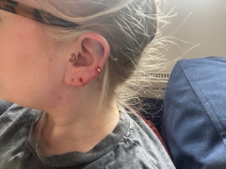 Ear damage - does this require medical attention?