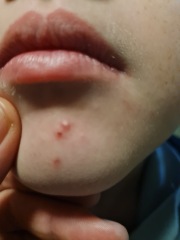 Dd (9) keeps getting odd looking spots