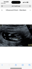 Boy or girl?