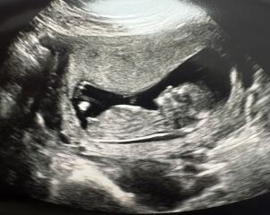 Due July 2026 🤍
