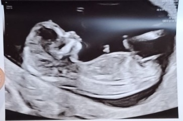 Boy or girl???